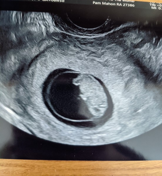 June 2021 thread 2
