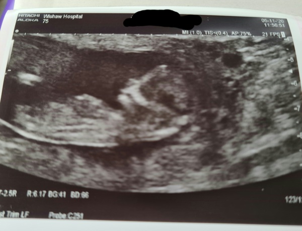 First Trimester Scottish Mamas
