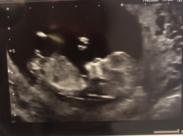 I'm thinking it's a girl. What do you think?