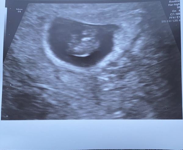 Early Scan