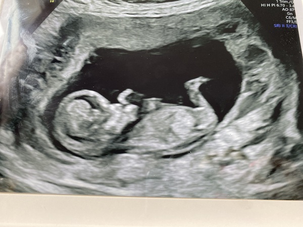 I have two girls, expecting our 3rd baby May 2021 -