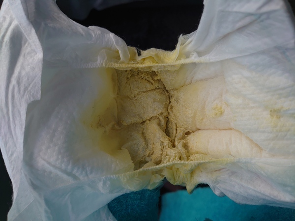 Is this poo cause for concern (picture inside)