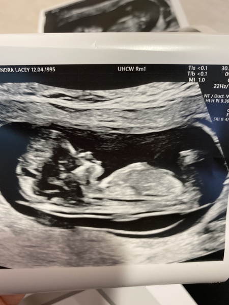 Gender Guesses!!