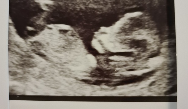 Gender prediction