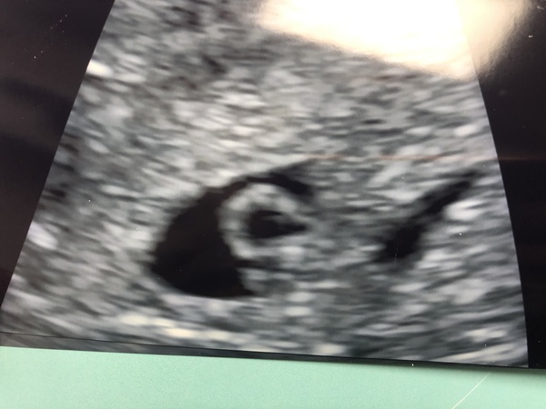 June 2021 thread 2