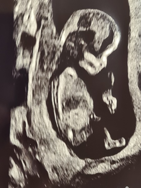 Gender prediction