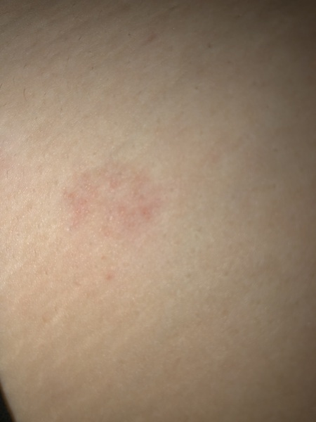 Any idea what this patch is on my chest