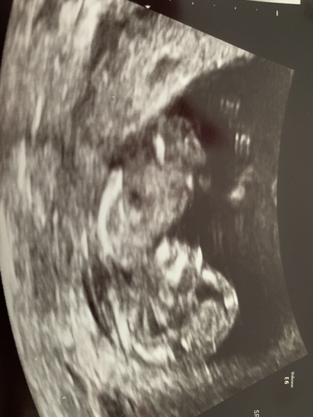 June 2021 thread 2