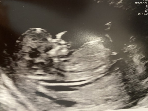 Girl or boy guesses please