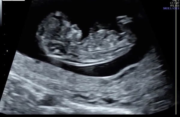 Any guesses?? :)