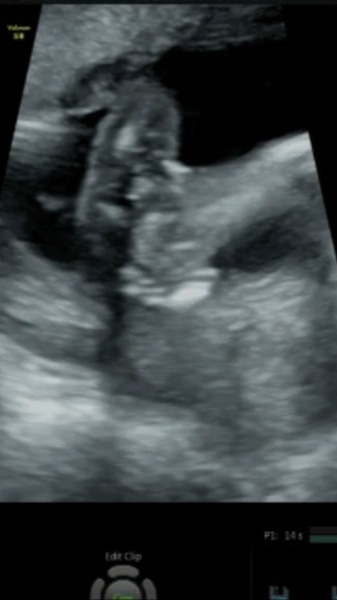 16 weeks potty shot...