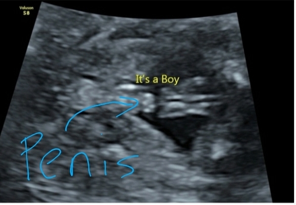 Gender