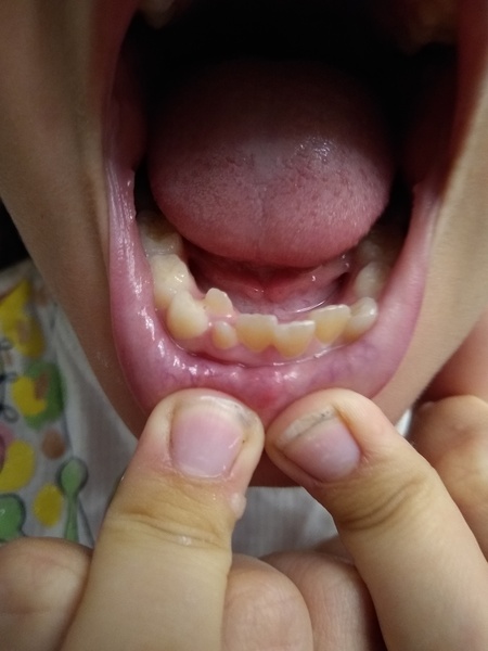Help from a dentist?