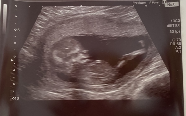 Plus size ladies? When did you start to get a bump...