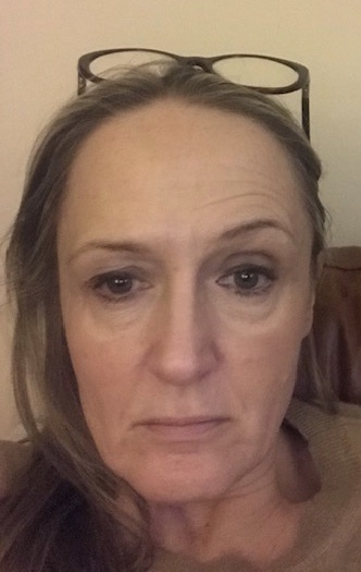 Have noticed my drooping eye is getting worse (pic)