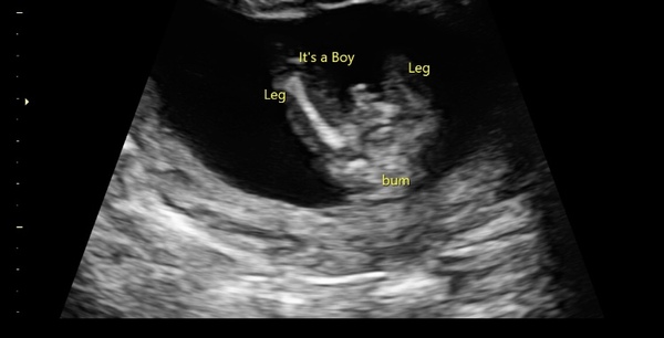 Gender guess