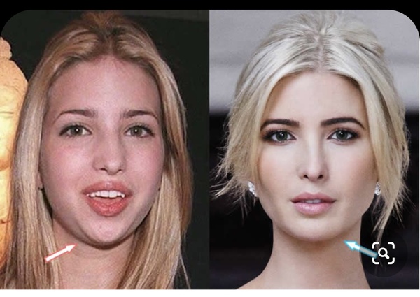 To think Donald Trump Jr is an attractive man?