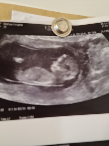 Guess the gender