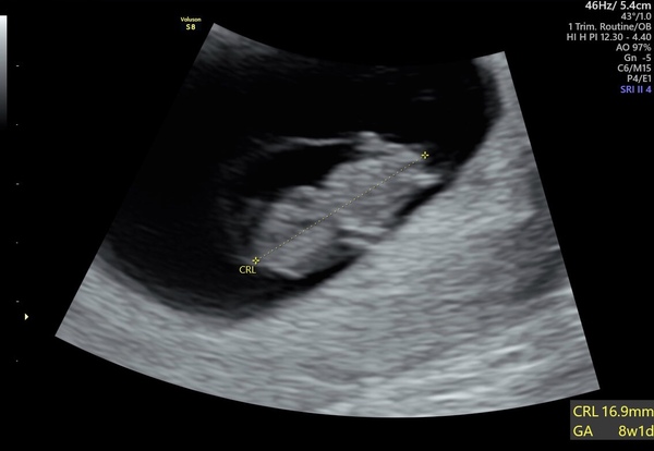 First time Mums in London / South East due summer 2021