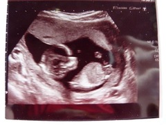 12 + 20 week scan gender guesses