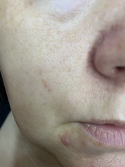 LARGE pores and crap skin