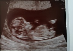 Is anyone else due on the 22nd may 2021?