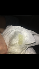 Mucus plug at 27 weeks? Positive preterm labour risk test.