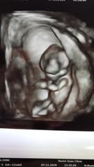 Early Guesses. Boy or Girl! ❤️