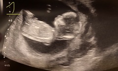 Gender guesses for pregnant twin sisters 3 weeks apart!