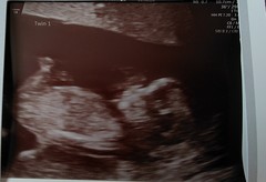 Is anyone else due on the 22nd may 2021?