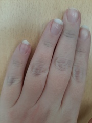 Creases on fingers blueish