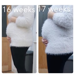 Pregnant After MMC - Thread 4