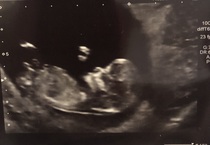 I'm thinking it's a girl. What do you think?
