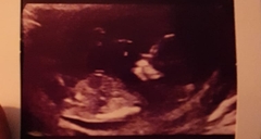 Nub Theory?! Girl or Boy?