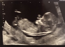 I'm thinking it's a girl. What do you think?
