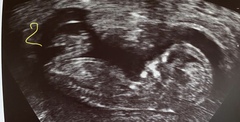 Gender guesses for pregnant twin sisters 3 weeks apart!