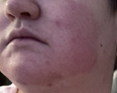 What does this rash look like?