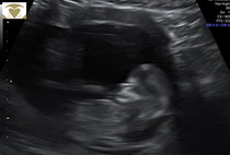 just for fun - boy or girl!?