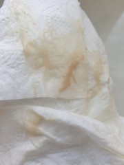 Help!!!!! Is this my mucus plug? I am 10 weeks. TMI pictures included!!!!!!!!