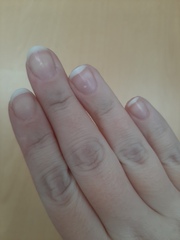 Creases on fingers blueish