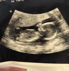Gender guess
