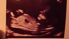 Nub Theory?! Girl or Boy?