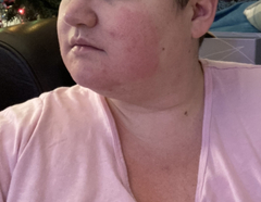 What does this rash look like?