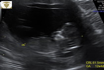 just for fun - boy or girl!?