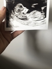 Early Guesses. Boy or Girl! ❤️