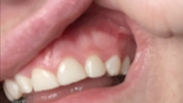Any dentists about - what’s the chances I’m going to lose my teeth?