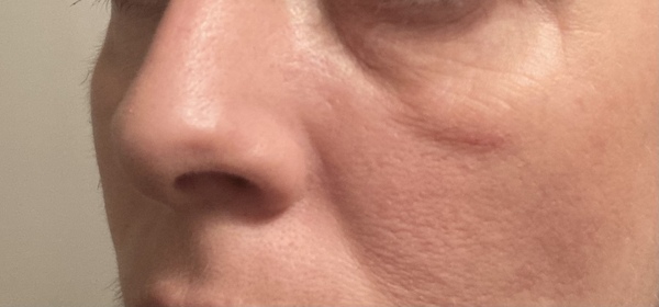 Can I fix my puffy, tired looking face (with photos)?