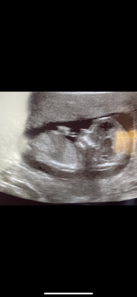 Do you want me to guess the sex? 12 week scans.