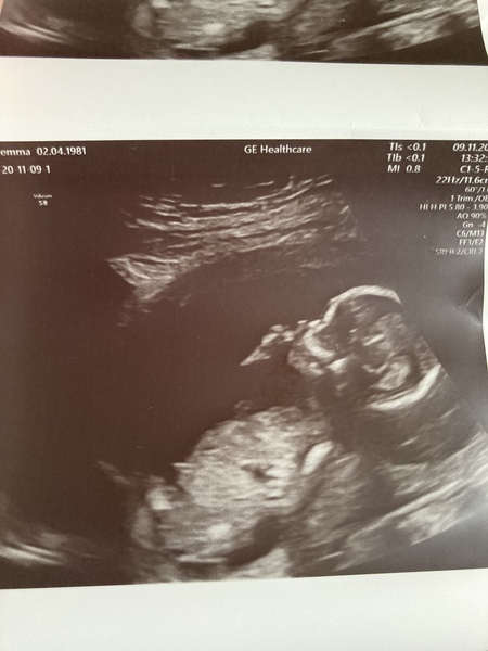 Do you want me to guess the sex? 12 week scans.