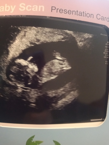 Do you want me to guess the sex? 12 week scans.